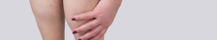 Spider legs reaching down woman in 30s shutterstock_1127173766