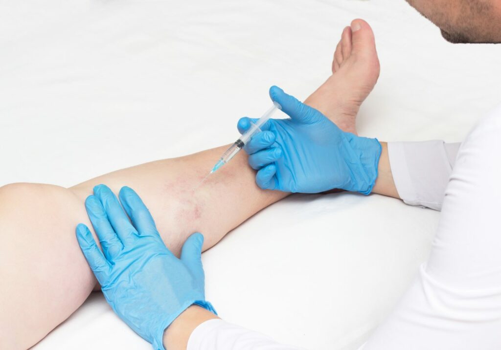 How long does it take for spider veins to disappear after laser treatment? We discuss the benefits and limitations of laser therapy for spider vein treatments.